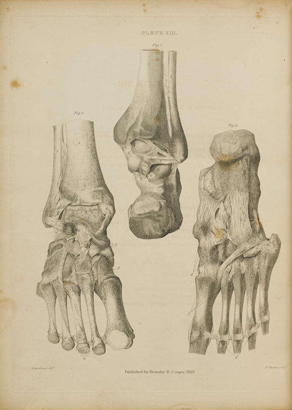 Bonhams : ANATOMY. 1. SCARPA, ANTOINE. Traite pratique des hernies, ou ...