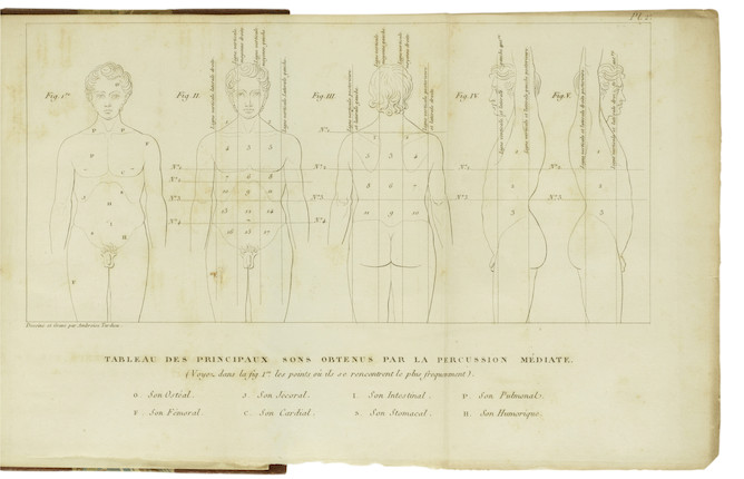 Bonhams PIORRY, PIERRE ADOLPHE. 17941879. De la percussion médiate